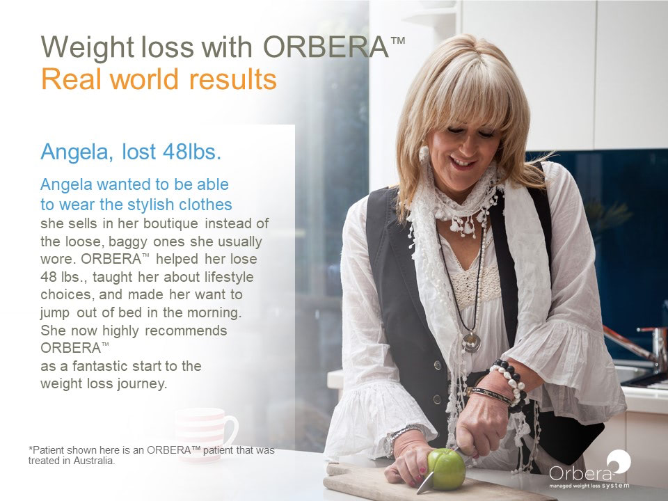 Orbera Balloon Weight Loss System Testimonial from Angela