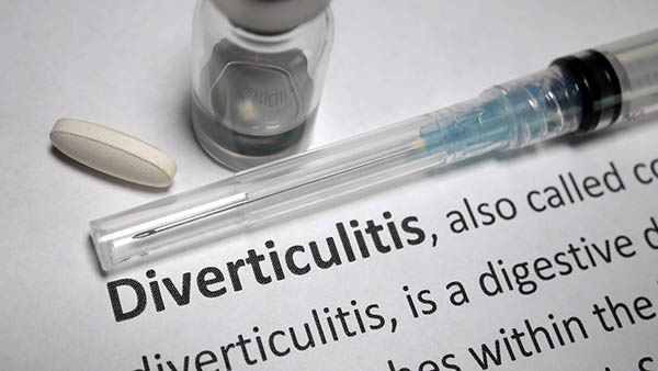 Diverticulitis Inflammation Or Infection ﻿— Diverticulitis - Gastro Florida 