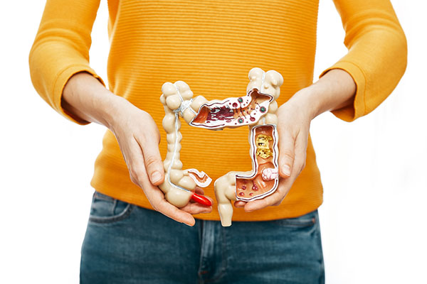 Crohn’s Disease, A Type Of IBD