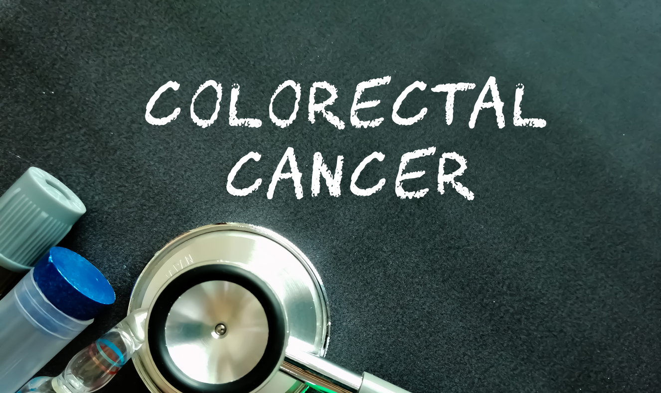 Early Age Onset Colorectal Cancer