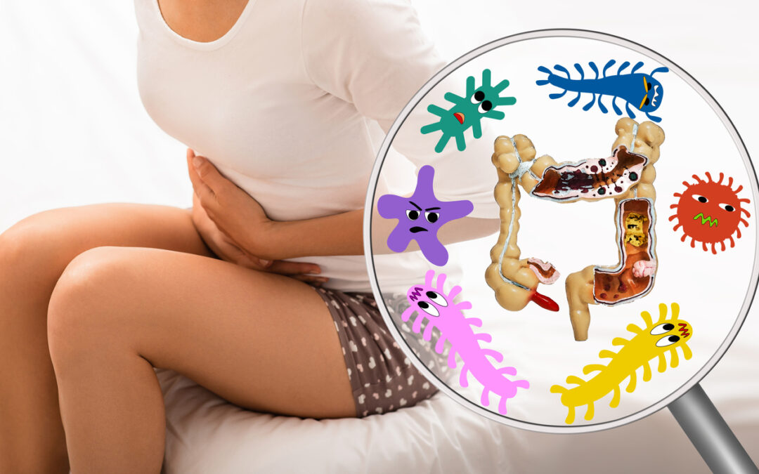 What Do We Know About Crohn’s Disease