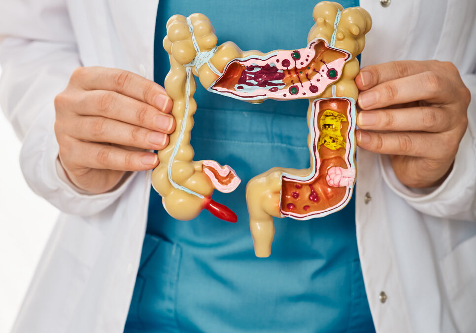 The 6 Things You Should Know About Managing Crohn’s Disease Symptoms – From Abdominal Pains to Diarrhea