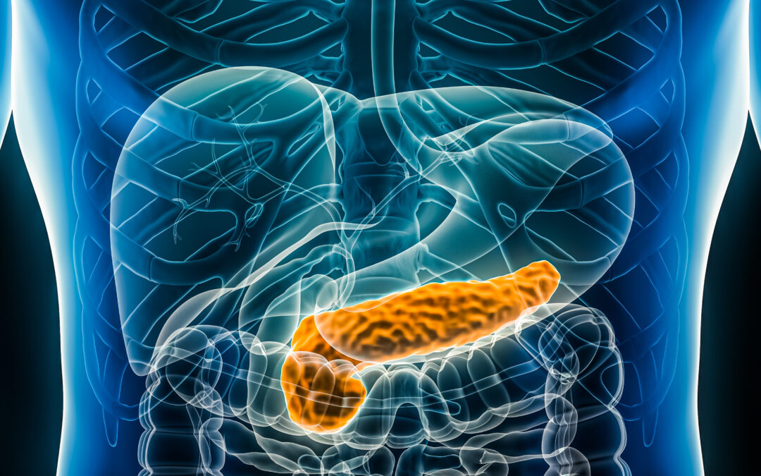 Pancreatitis: The Fury of an Inflamed Pancreas