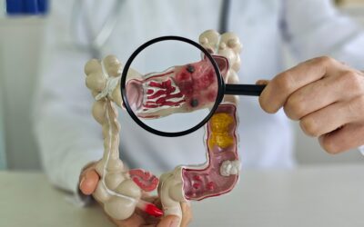 Colorectal Cancer Awareness Month: Screening Saves Lives